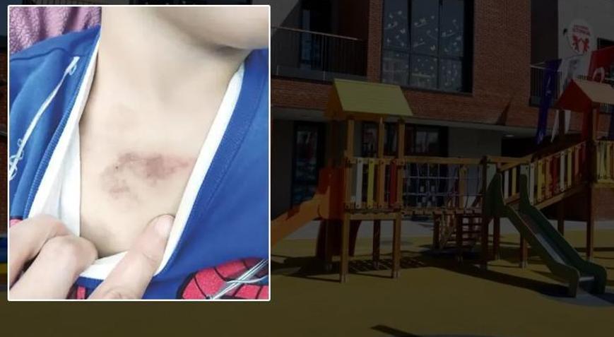İBB kreşinde darp ve istismar iddiası İstanbul Valiliği soruşturma başlattı