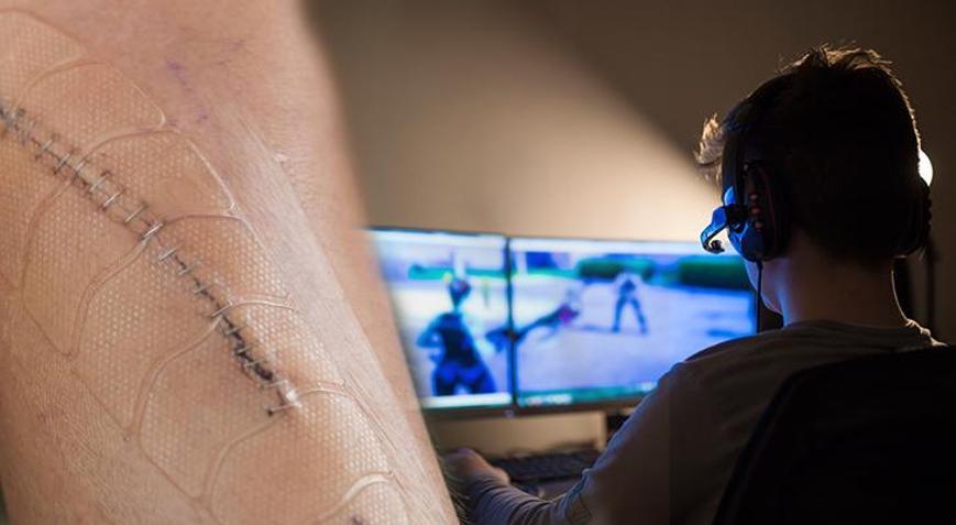 Diz ameliyatından çıktı ana dilini unuttu: Kendini ABDde sandı Peki sebebi oyunlar mı