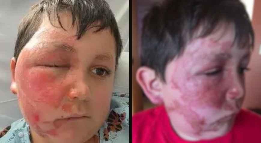 Sosyal medya akımı kör ediyordu, 9 yaşındaki çocuk dehşeti yaşadı Anneden şaşırtan ifade