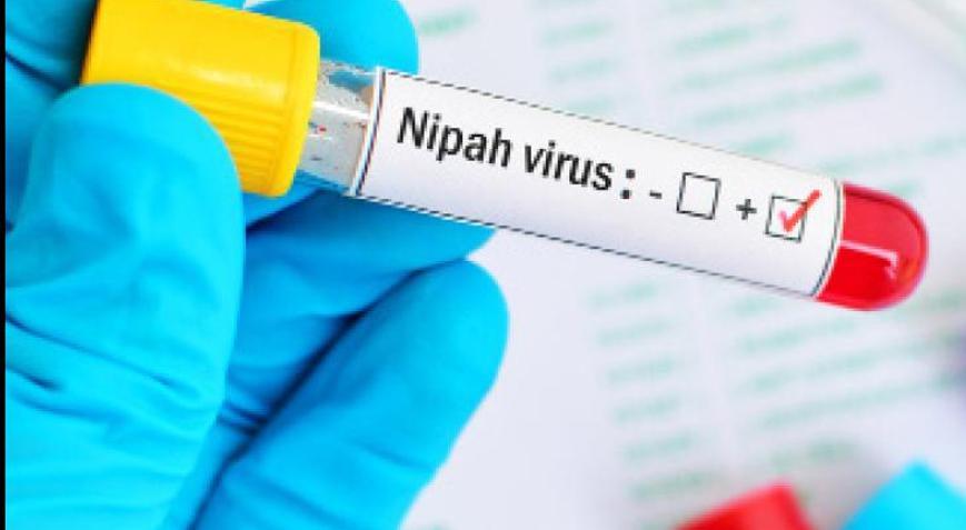 Nipah virüsü ile ilgili merak edilenler