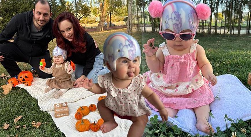 Doğumda öğrendikleri teşhis hayatlarını değiştirdi ‘Doktorun ağzından duymak dünyamı yıktı’