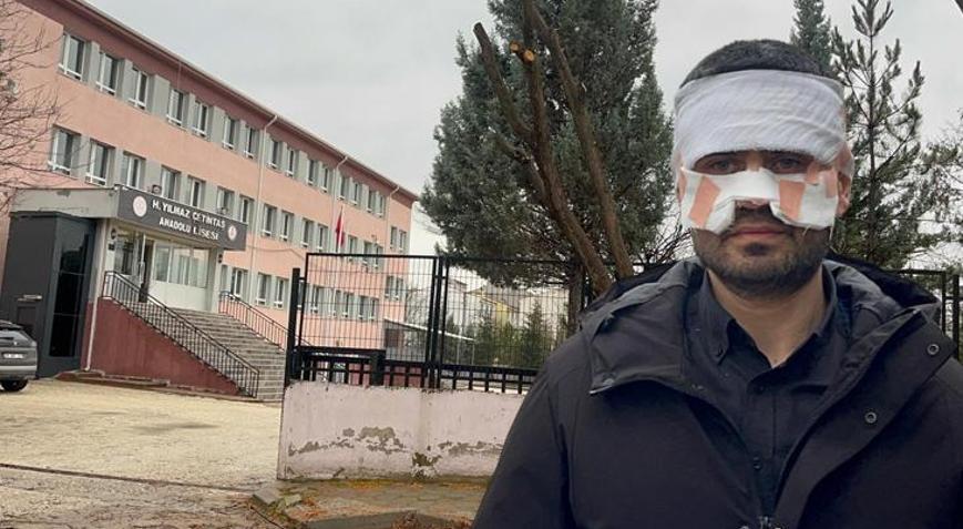 Okulda dehşete düşüren olay Rehber öğretmen, Fizik öğretmenini kaynar çayla haşladı