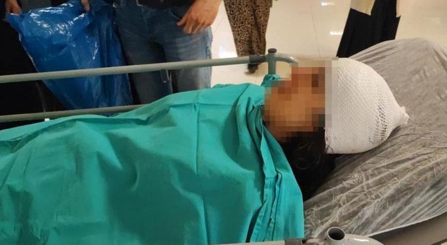 Ekmek almaya giden genç kız dehşeti yaşadı 3ü birden saldırdı: ‘Kafasında 20 santimlik bir açık var’