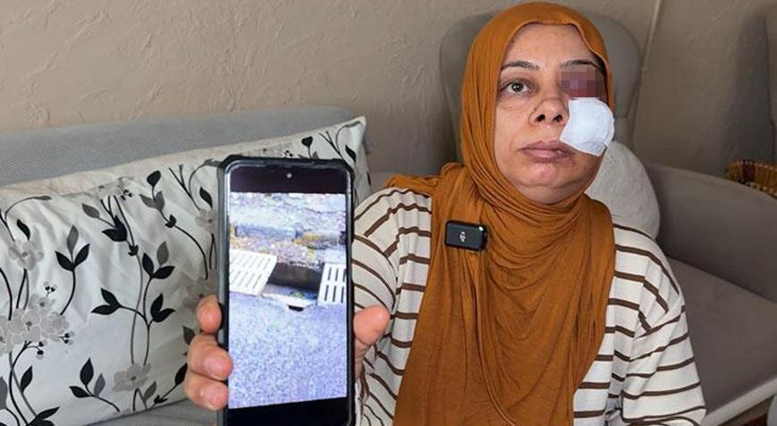 Elektrikli bisikletiyle rögara düştü Dişleri kırıldı, yüzüne 14 dikiş atıldı