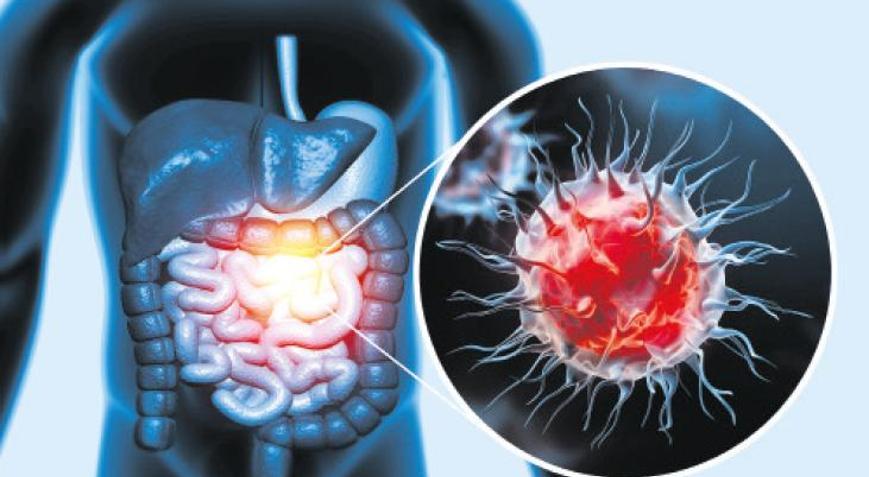 50 yaş altı kolon kanseri alarmı