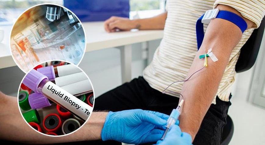 Koldan alınan bir tüp kanla kanser analizi Onkolojide devrim gibi gelişme: PETten aylar önce anlaşılabilir...