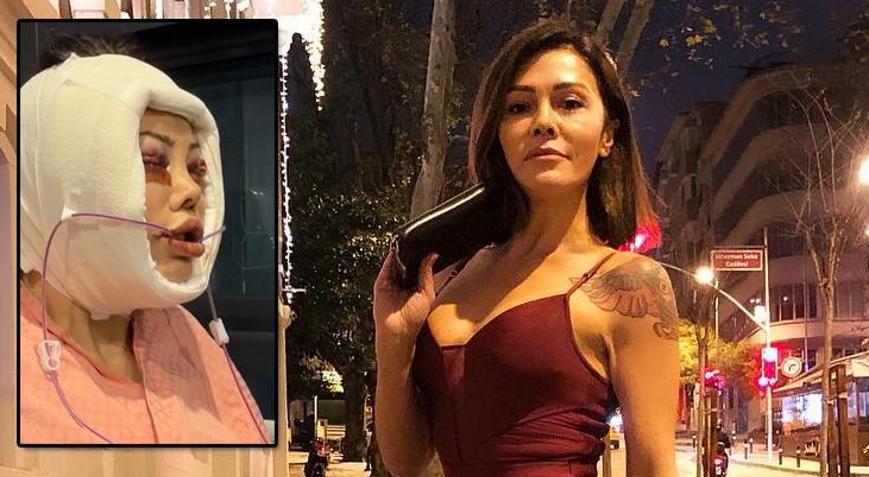 Korede yüz nakli yaptırmıştı Didem Ceran hastalığını ilk kez açıkladı: Saklamak istemiyorum