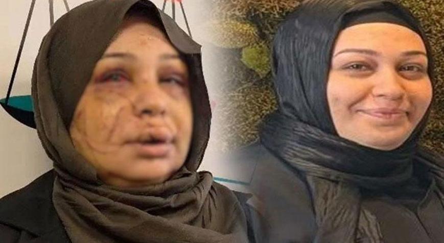 Eşinin yüzünü 60 dikiş atıldı Kendini böyle savundu: Ben büyük bir aile katliamını önledim