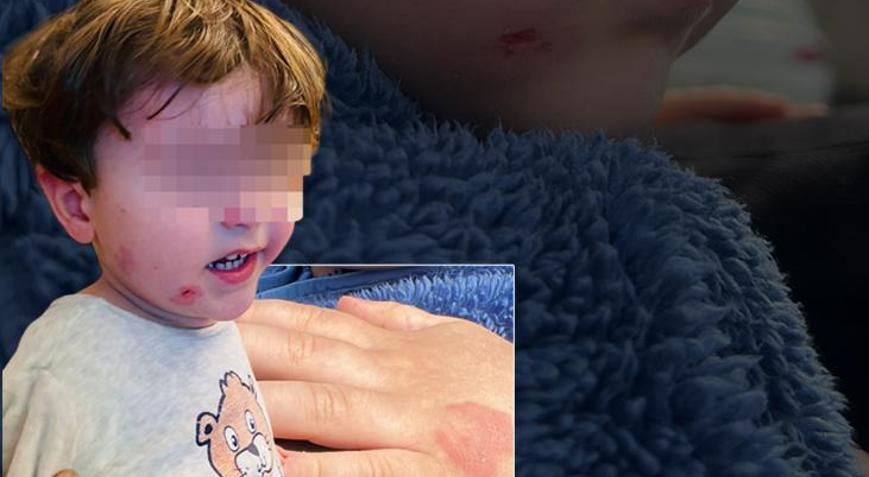 Özel kreşte skandal olay 2,5 yaşındaki çocuk darp edildi