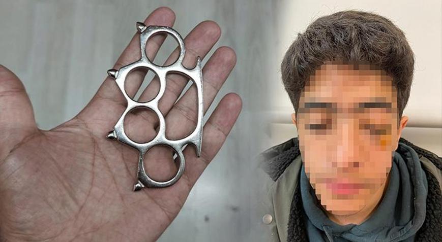 Esenyurt’ta akran dehşeti Gözünü kaybetme riskiyle ameliyata alınan çocuğun yüz kemikleri kırıldı