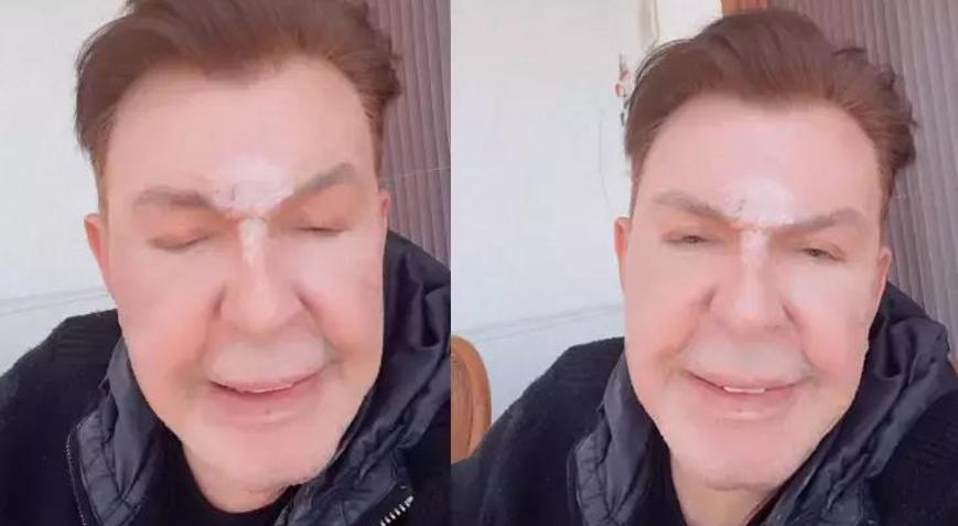 Yüzünü gerdiren Kuşum Aydın isyan etti: Benden bu kadar