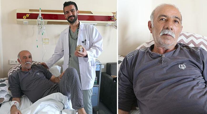 Mesanesinden çıkan taş doktorları şoke etti Bayılmak istedim, böyle bir şey olamaz