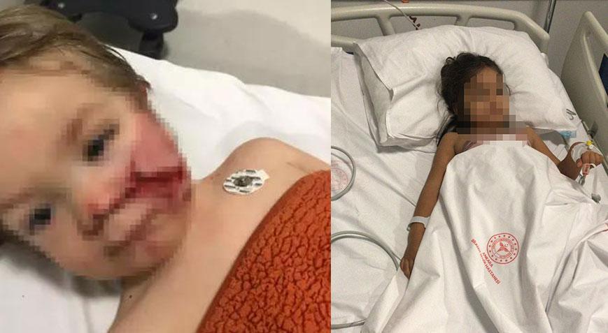2 kardeşe saldırıp yaralayan pitbullun sahibi hakkında karar Çocuğumu mahvettiler
