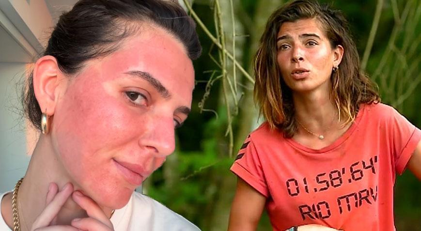 Survivor Merve Aydın’ın değişimi şaşırttı Yüzüne yaptırdığı işlemi tek tek anlattı