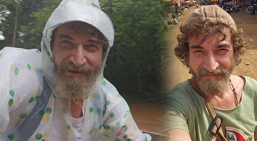 Yüzde 50 yürüme şansından bisiklet turuna 8 çivi, bir plaka ve kemik nakliyle yola çıkıyorum