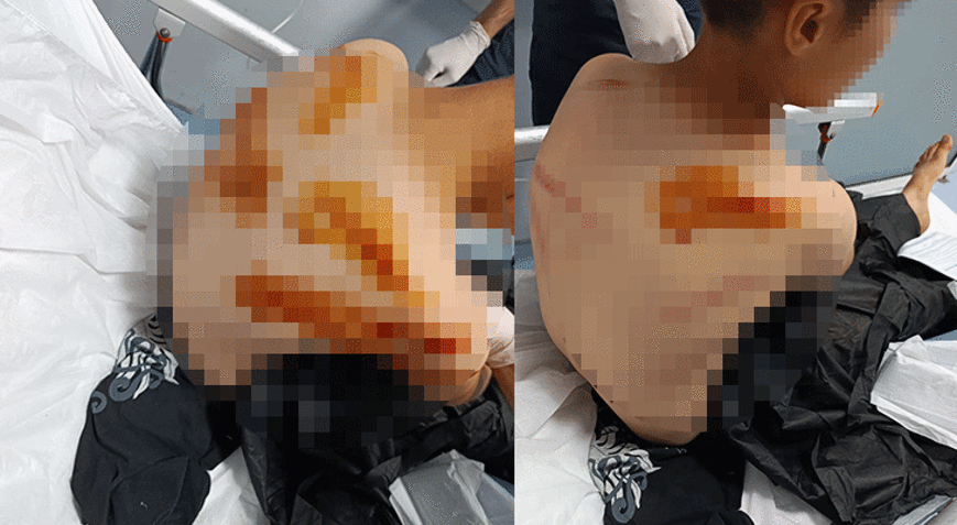 Şanlıurfada komşu dehşeti 11 yaşındaki çocuğu sokak ortasında sopayla öldüresiye darbetti
