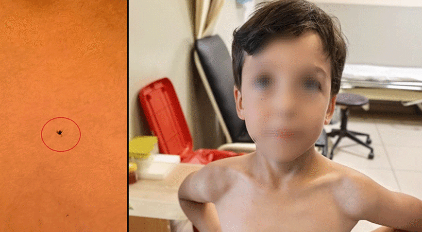 Oyun oynarken fark etti 7 yaşındaki çocuğun göğsüne kene yapıştı