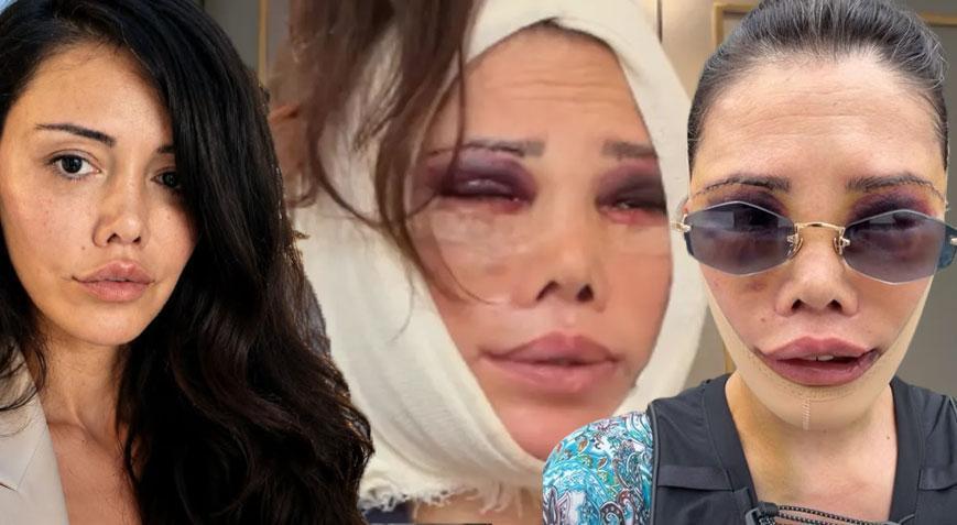 İkinci kez yüz nakli olmuştu Didem Ceran’dan peş peşe çarpıcı açıklamalar: Hiç kimsem yok, tek başıma savaşıyorum