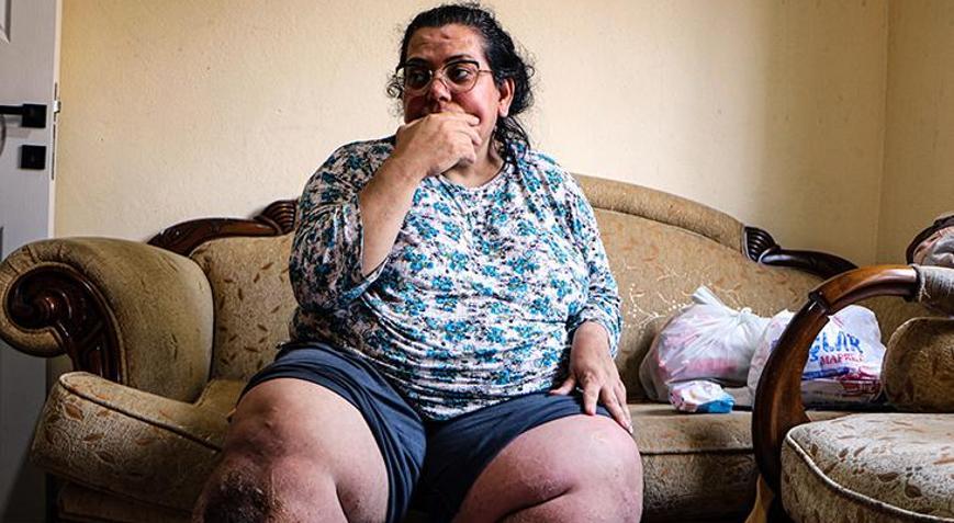 Fil hastası 3 çocuk annesi, tedavi olmak için yardım bekliyor: Yaralarda kurtlanma oluşuyor