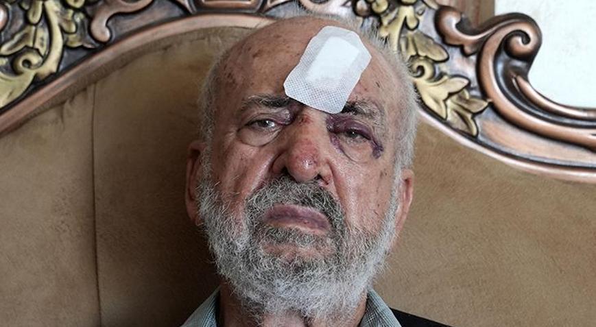 İsrail askerlerinden 80 yaşındaki Filistinliyi darbederek yaraladı