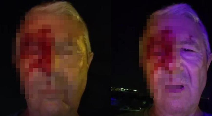 Haber yaparken saldırıya uğrayan muhabir yaralandı