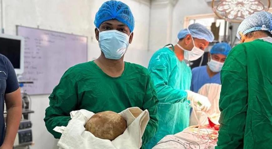Sri Lankada akılalmaz ameliyat: Hastadan 3.1 kiloluk mesane taşı çıkarıldı