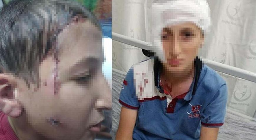 Yüzünde 12 santimlik iz bıraktı Milyonluk tazminat kararı