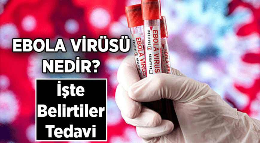 DÜNYA SAĞLIK ÖRGÜTÜ UYARDI 💥 Ebola salgını nedir, nerede var Ebola virüsü belirtileri nelerdir, bulaşıcı mı, nasıl bulaşır