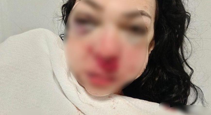 İzmit’te kafe kavgası Kadının yüzüne kül tablası ve bardak fırlattı