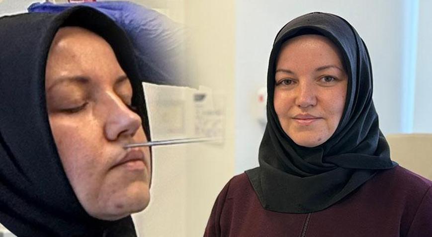 Yıllarca alerji sandığı burun akıntısının nedenini öğrenince şoka girdi