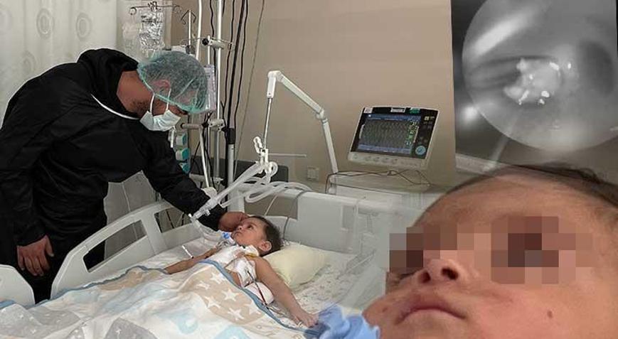 Ablasının oynadığı ceviz, 1 yaşındaki Atayı hastanelik etti: Bu durum doğrudan ölüm
