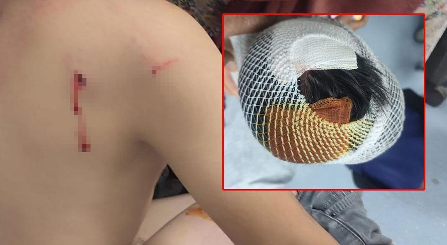 Başıboş köpek dehşeti 8 yaşındaki çocuk hastanelik oldu