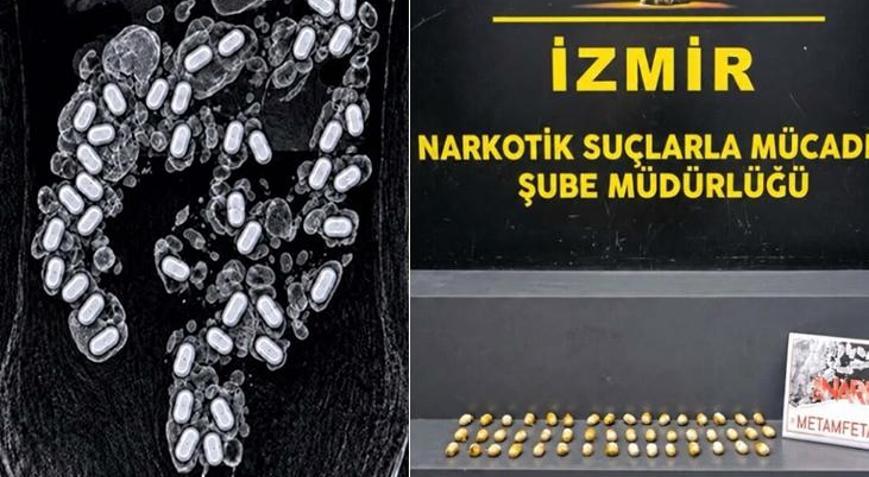 Havalimanı polisinin dikkatinden kaçamadı Midesinde uyuşturucu taşıyan yolcu böyle yakalandı
